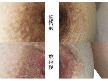 吉乃 大和高田有井店/ローマピンク　【バスト】