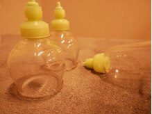 ケアメディカル鍼灸整骨院/美容にも注目、カッピング