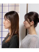 あらかき接骨院/【美容鍼】