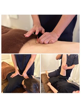 エメリリア 立川店(Aimerlilia)の写真/家事育児で限界の首肩こりに。【鍼】でツボへダイレクト刺激。根本原因である“深部”に届くから効く！