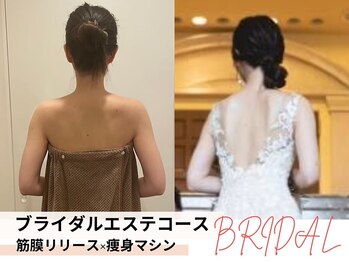 痩身&ブライダルエステサロン MillS 小倉店【3/2 NEW OPEN（予定）】/ブライダルエステコース