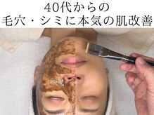 ミーツ(Meets)の雰囲気(エクソソームハーブピーリングで「オトナの艶肌」ダウンタイム無)