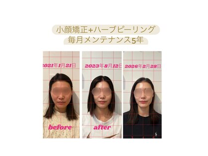 ビボーン ボディ(美bone body)の写真