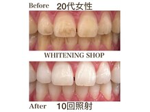 ホワイトニングショップ 池田店の雰囲気（店内は白基調のプライベート空間です。リクライニング付で快適!）
