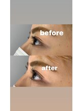 エーウイング(A.Wing.)/