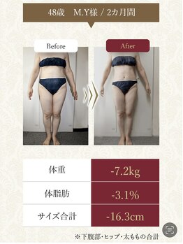 キノ(Kino)/セルライトゼロ★