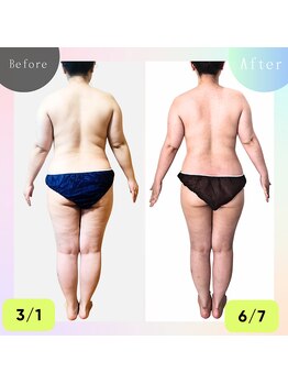 ナチュラルボディラボ 草津店/肩こり解消！