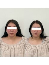 ヴェルシック(Belchic)/セットでさらにお悩み改善