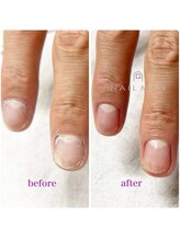 ネイルマン 横浜店(Nail Man)/ハンドケアのビフォー＆アフター