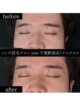 ユー 千葉駅前店(you)/ビフォ-アフター写真