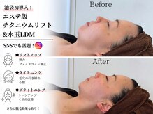 ラヴィニティ 池袋(Lavinity)の雰囲気（SNSで話題！池袋初！エステ版チタニウムリフト＊モニター募集）