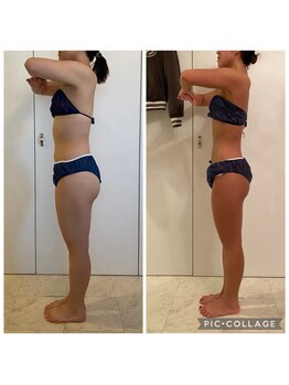 ラナ(LaNa)の写真/【短期集中で結果が出る！】セルゼロ2×ヒートマットで夏までに理想ボディへ◎