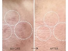 ココリラ(cocorira)の雰囲気（最新《シミ回収》シミケア効果抜群です★ご相談だけでもOK◎）