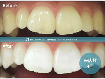 セルフホワイトニング専門店 シマエナ上新庄駅前店/自然な白い歯へ
