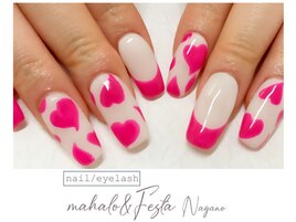 スカルプ10本　つけ放題コース