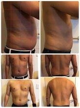 ビオナス(BIONAZ)/男性も努力なし！！