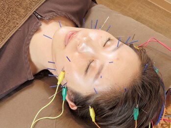 キズシンキュウ(KIZU SHINKYU)の写真/《乾燥に負けないうるおい美肌を目指しませんか？》お肌を内側から美しく◎みずみずしい生ツヤ肌へ…☆