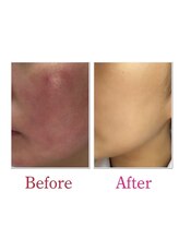 スペチアーレ 夙川/植物パワーでツルスベお肌