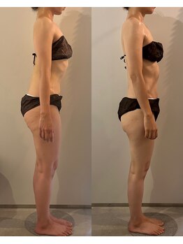 ラナ 京都西院店(Lana)/身体の歪み・腰痛改善