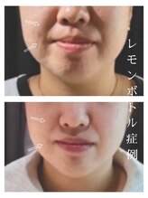 カピリナスパ(Ka.Pilina Spa) レモン ボトル