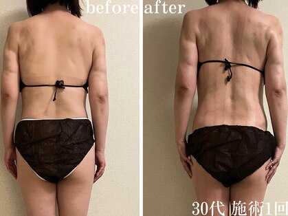 アビヤンガの写真