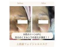 ランプシー(Lampsi)の雰囲気(エイジングケア!細胞や筋肉に働きかけるエステ☆)