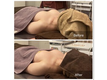 ベンザイ 梅田店(BENZAI)/バストUP、産後ケア