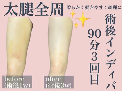 エステサロン ヴリエ 立川店の写真