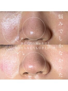 ソワ 吉塚店(soi)/肌全体のくすみが消える!