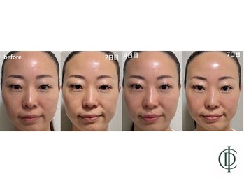 ベラ 東京院(Bella)/インセルダム-ICD-韓国最新美容