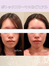 エン 橿原店(en)/20代からの美容投資