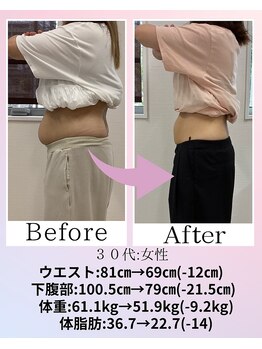 あいら骨盤整体院の写真/【10キロ以上本気で痩せたい方!】体重だけでなく人生まで変わるかもしれません♪