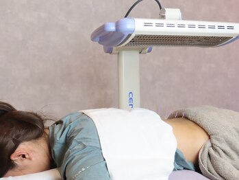 レコフィット(Recofit)の写真/【鍼灸×中国整体★】鍼灸で深部へアプローチ＋整体でじっくりもみほぐし、つらい首肩コリ・疲れをケア♪