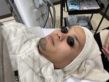 エトワール(etoile)/男性髭脱毛