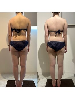 ラナ 京都西院店(Lana)/全身リンパマッサージ