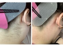 ルル(RuRu)/ Wax脱毛