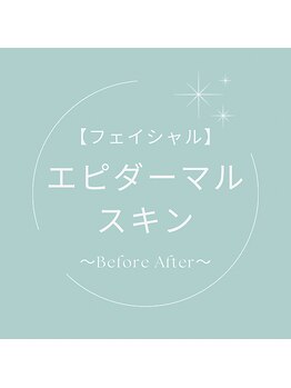 プリドー(PULIDO)/エピダーマルスキン
