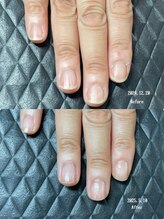 クーラ アンド ベリッシモ(Cura&Bellissimo)/