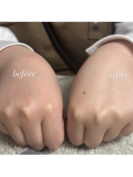 ルート12/ハンドケア♪