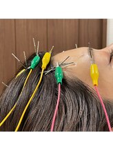 キャンディ鍼灸整骨院/施術風景