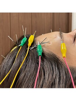 キャンディ鍼灸整骨院/施術風景