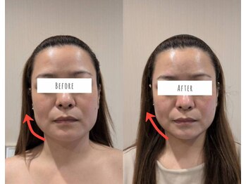イチグラム(Ichi Glam)の写真/《結果重視で高持続力》多くの方が即実感で若見え印象に☆