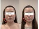 イチグラム(Ichi Glam)の写真/《結果重視で高持続力》多くの方が即実感で若見え印象に☆