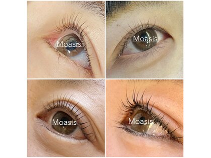 モアシス(Moasis)の写真