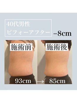 フラットベリー 恵比寿(Flat BELLY)/100分コース