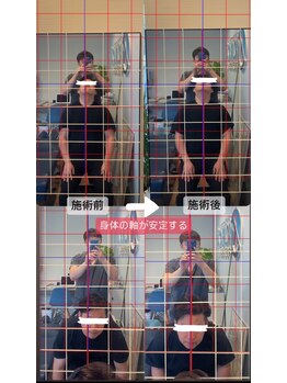 神経活性整体院クラタ(神経活性整体院KURATA)/【京橋整体院】身体の傾きが整う