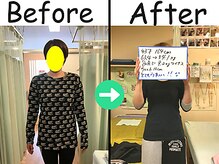 杉本接骨鍼灸院/ 【ダイエット】43歳　9.3キロ
