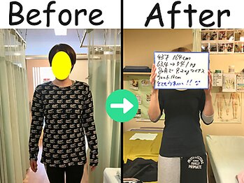 杉本接骨鍼灸院/ 【ダイエット】43歳　9.3キロ