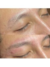 エピシアドットエヌ(epicia.N)/眉毛ひとつで変わる印象