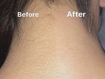 ハリウッドブロウリフト ワクシー 新宿店(HOLLYWOOD BROW LIFT WAXYYY.)/ワックス脱毛